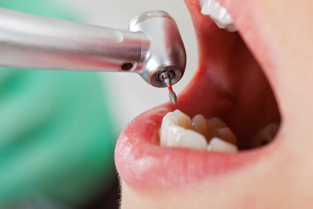 Best Dentist for Tooth Abscess  in Annetta, TX
